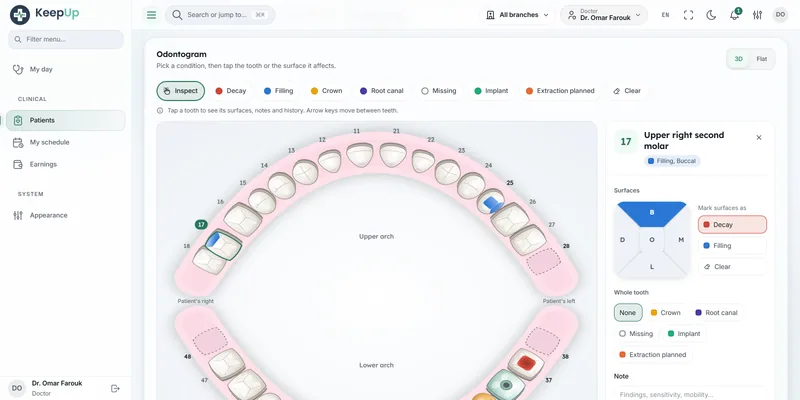 Screenshot: The dental chart: a 3D odontogram where the doctor marks conditions on each surface and keeps notes per tooth.
